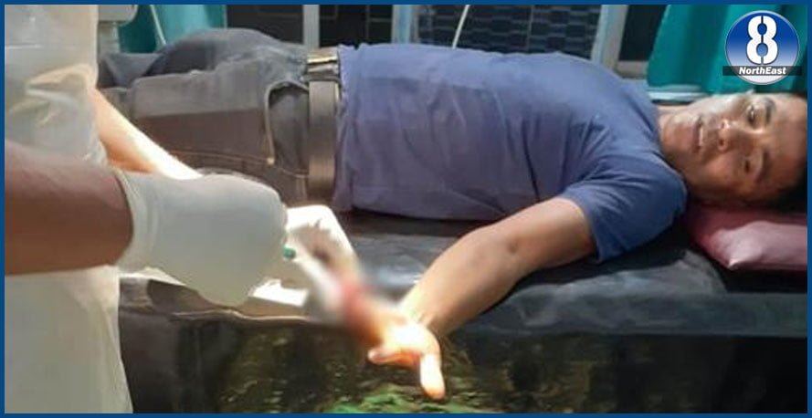852