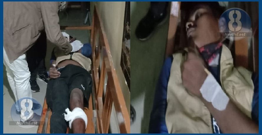পুনৰ এনকাউণ্টাৰ! আৰক্ষীৰ গুলীত আহত কুখ্যাত ডকাইত ভোটকো... 1 122