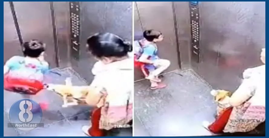 dog bite child