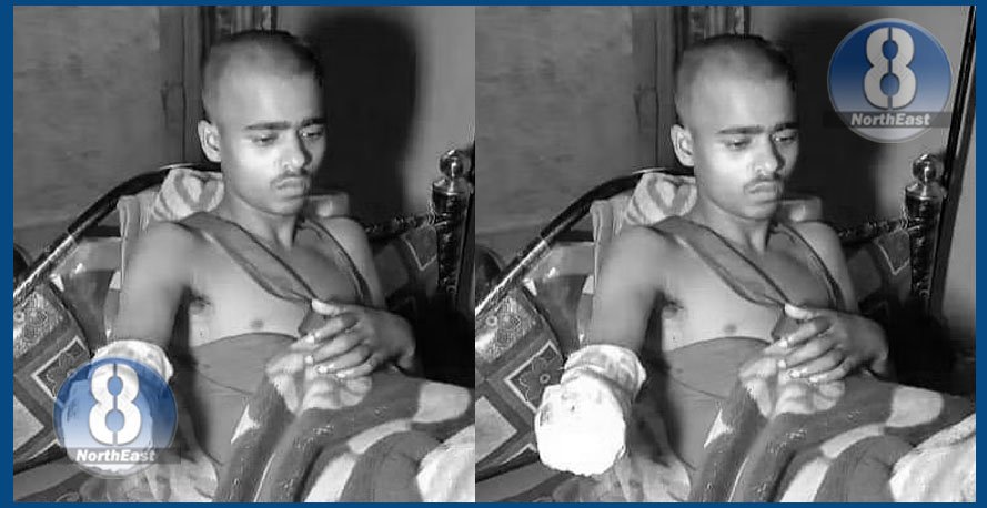 ঘৰলৈ উভটি ফইজুল... গুৱাহাটীতে এৰি থৈ আহিল ৰং কৰি ভাত মোকোলোৱা এখন হাত... 1 45