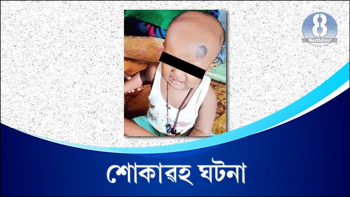 Child Dies in Wasp Attack Small