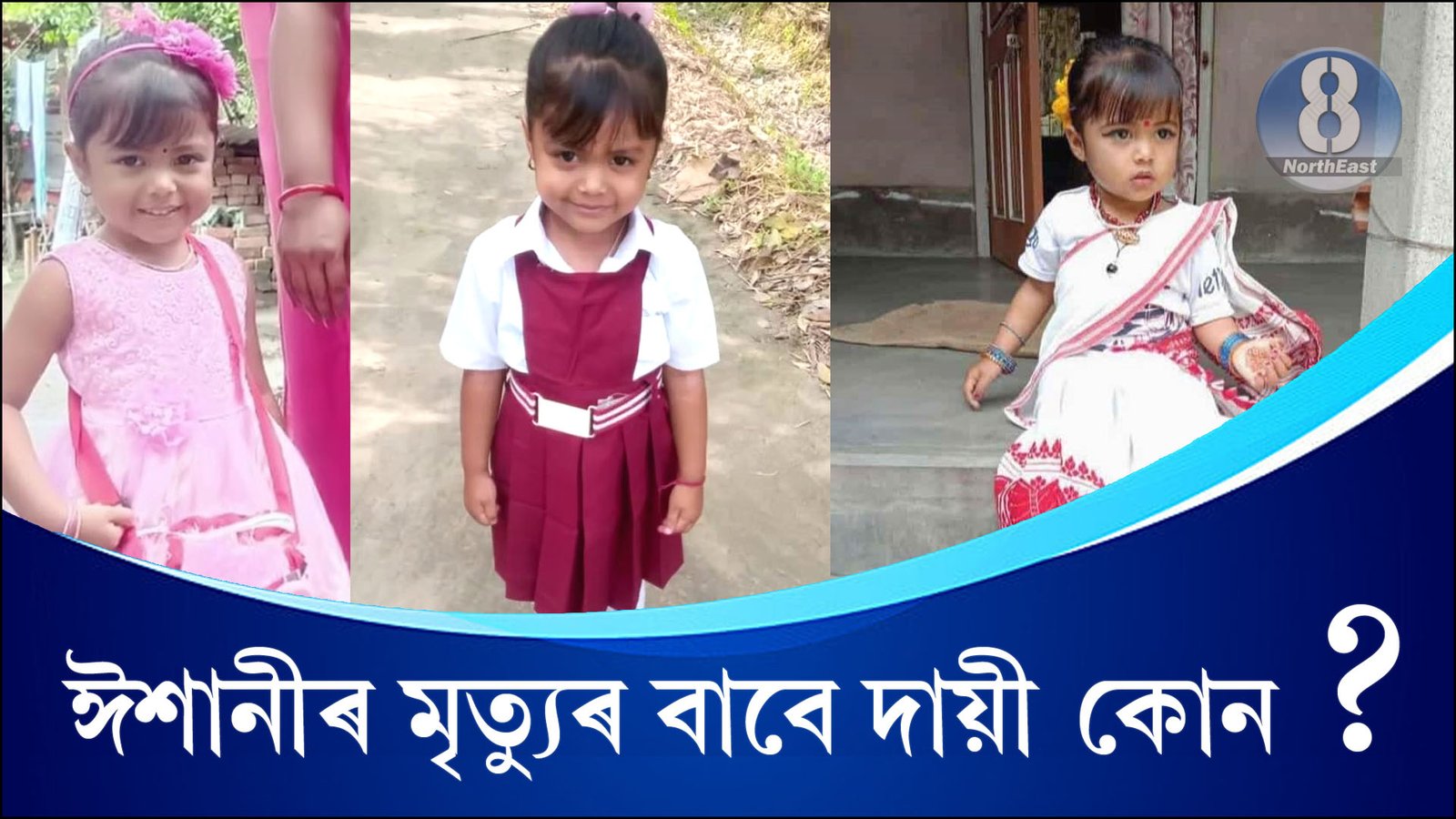 Snakebite Nalbari 1